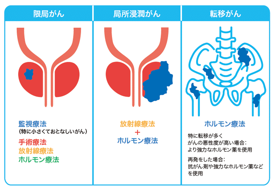 前立線がんについて - 特定非営利活動法人 前立腺がん検診推進ネットワーク